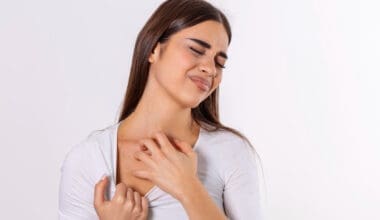 Young woman scratching her neck due to itchy psoriasis