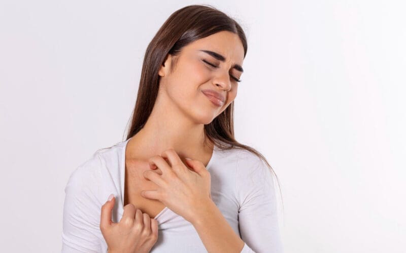 Young woman scratching her neck due to itchy psoriasis