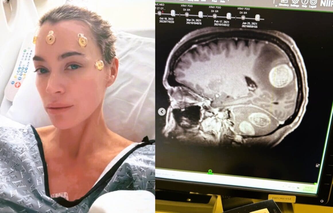 Teddi Mellencamp is sharing an update on her brain surgery. Photo by Teddi Mellencamp / Instagram.