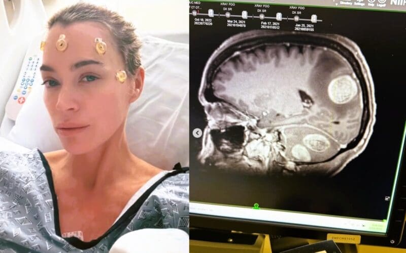 Teddi Mellencamp is sharing an update on her brain surgery. Photo by Teddi Mellencamp / Instagram.